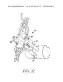 Surgical Access System and Related Methods diagram and image