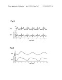 Pressure-sensitive conductive yarn and biological information-measuring garment diagram and image