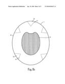 Membrane envelop bandage for application of medicine or ointment diagram and image