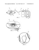 SYSTEMS AND METHODS FOR IMPROVED CONNECTION TO WOUND DRESSINGS IN CONJUNCTION WITH REDUCED PRESSURE WOUND TREATMENT SYSTEMS diagram and image