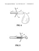 METHOD FOR TREATING OBESITY BY EXTRACTING FOOD diagram and image