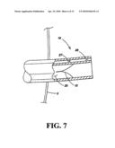 METHOD FOR TREATING OBESITY BY EXTRACTING FOOD diagram and image