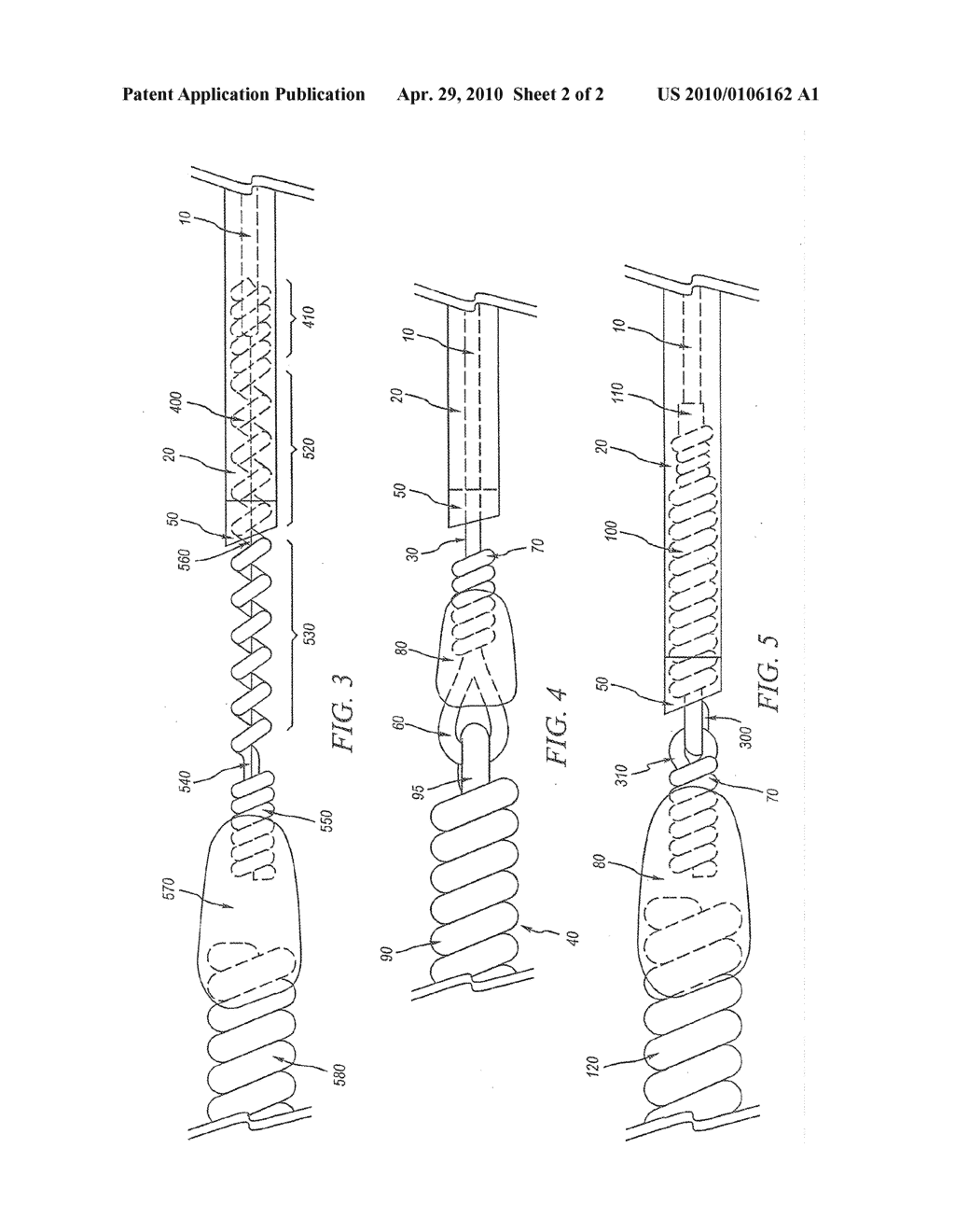 FLEXIBLE EMBOLIC DEVICE DELIVERY SYSTEM - diagram, schematic, and image 03