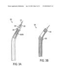 TRANSCAVAL MESENTERIC VENOUS ANASTOMOSIS AND ACCESS SYSTEM diagram and image