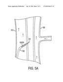 TRANSCAVAL MESENTERIC VENOUS ANASTOMOSIS AND ACCESS SYSTEM diagram and image