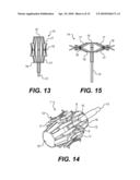 MECHANICAL ANASTOMOSIS SYSTEM FOR HOLLOW STRUCTURES diagram and image