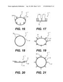 MECHANICAL ANASTOMOSIS SYSTEM FOR HOLLOW STRUCTURES diagram and image