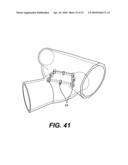 MECHANICAL ANASTOMOSIS SYSTEM FOR HOLLOW STRUCTURES diagram and image