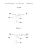 METHOD AND DEVICE FOR GRAFT FENESTRATION diagram and image