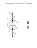 DEVICES, SYSTEMS, AND METHODS FOR ENDOSCOPIC GASTRIC MAGNETIC RESTRICTION diagram and image