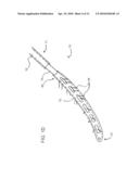 DEVICES, SYSTEMS, AND METHODS FOR ENDOSCOPIC GASTRIC MAGNETIC RESTRICTION diagram and image