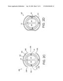 DEVICES, SYSTEMS, AND METHODS FOR ENDOSCOPIC GASTRIC MAGNETIC RESTRICTION diagram and image