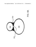 DEVICES, SYSTEMS, AND METHODS FOR ENDOSCOPIC GASTRIC MAGNETIC RESTRICTION diagram and image