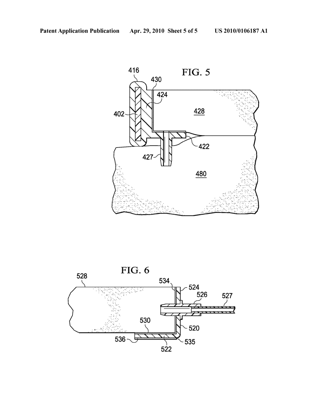 MODULAR, REDUCED-PRESSURE, WOUND-CLOSURE SYSTEMS AND METHODS - diagram, schematic, and image 06