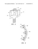 SYSTEM AND METHOD FOR ALIGNING VERTEBRAE IN THE AMELIORATION OF ABERRANT SPINAL COLUMN DEVIATION CONDITIONS IN PATIENTS REQUIRING THE ACCOMODATION OF SPINAL COLUMN GROWTH OR ELONGATION diagram and image