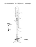 METHOD AND SYSTEM FOR ATTACHING A PLATE TO A BONE diagram and image