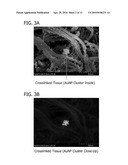 BIONANOCOMPOSITE FOR TISSUE REGENERATION AND SOFT TISSUE REPAIR diagram and image