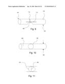 MEDICAL STENT diagram and image