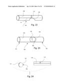 MEDICAL STENT diagram and image