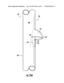 MEDICAL STENT diagram and image