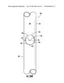 MEDICAL STENT diagram and image