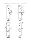 MEDICAL STENT diagram and image