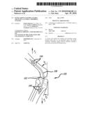 Extra-Articular Implantable Mechanical Energy Absorbing Systems diagram and image