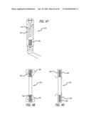 Extra-Articular Implantable Mechanical Energy Absorbing Systems diagram and image