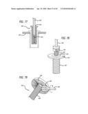 Extra-Articular Implantable Mechanical Energy Absorbing Systems diagram and image