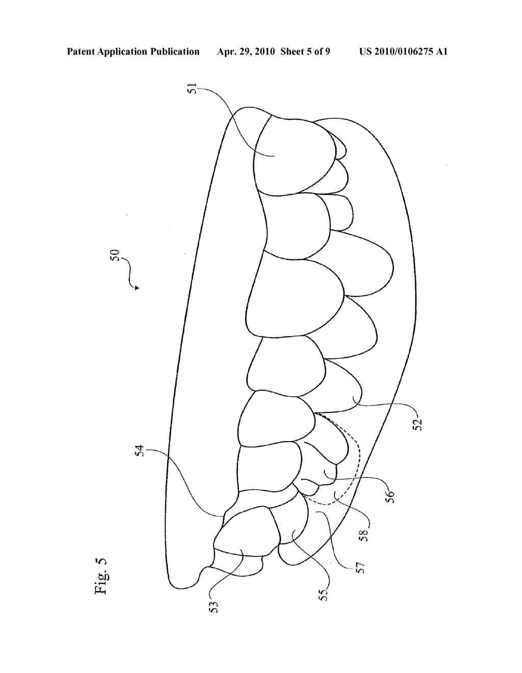 METHOD AND APPARATUS FOR OBTAINING DATA FOR A DENTAL COMPONENT AND A PHYSICAL DENTAL MODEL - diagram, schematic, and image 06