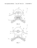 VENTILATOR MASK AND SYSTEM diagram and image