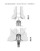 SURGICAL STAPLER diagram and image