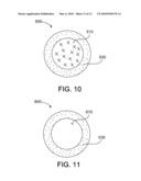 EMBOLIZATION diagram and image