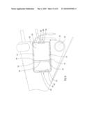 Infant Support Structure diagram and image