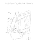 Infant Support Structure diagram and image