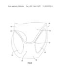 Infant Support Structure diagram and image