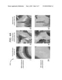 FAST VELOCITY MEASUREMENTS USING BALANCED SSFP MAGNETIC RESONANCE IMAGING diagram and image