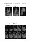 FAST VELOCITY MEASUREMENTS USING BALANCED SSFP MAGNETIC RESONANCE IMAGING diagram and image