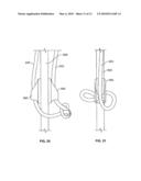 WASHOUT SYSTEM diagram and image