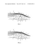 FLOWABLE COMPOSITION THAT HARDENS ON DELIVERY TO A TARGET TISSUE SITE BENEATH THE SKIN diagram and image