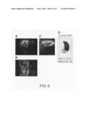 BRAIN-LOCALIZING POLYPEPTIDES COMPRISING A MULTIVALENT BINDING MOIETY AND IMPROVED METABOLIC STABILITY diagram and image