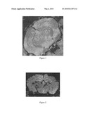 USE OF METAL NANOPARTICLES IN THE DIAGNOSIS OF ALZHEIMER S DISEASE diagram and image