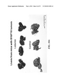 METAP-2 INHIBITOR POLYMERSOMES FOR THERAPEUTIC ADMINISTRATION diagram and image