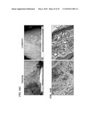 METAP-2 INHIBITOR POLYMERSOMES FOR THERAPEUTIC ADMINISTRATION diagram and image