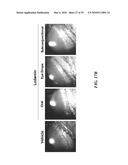 METAP-2 INHIBITOR POLYMERSOMES FOR THERAPEUTIC ADMINISTRATION diagram and image