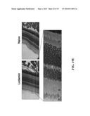 METAP-2 INHIBITOR POLYMERSOMES FOR THERAPEUTIC ADMINISTRATION diagram and image