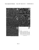 NOVEL HYDROGEL COMPOSITIONS AND METHODS OF USING diagram and image