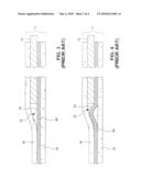 USING IONOMER TO MILITATE AGAINST MEMBRANE BUCKLING IN THE TENTING REGION diagram and image