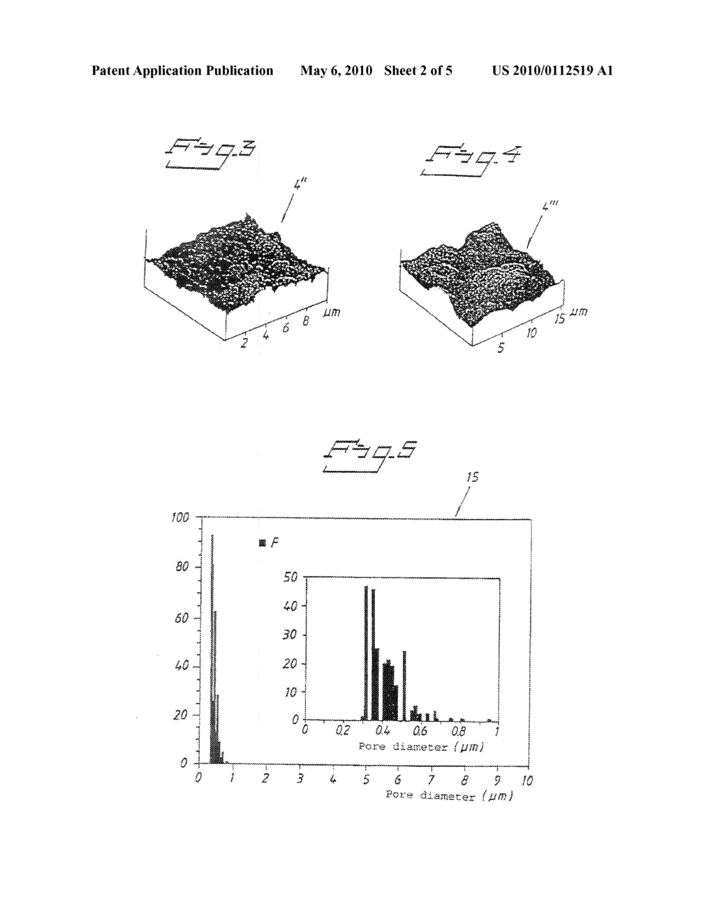 IMPLANT, METHOD FOR PRODUCING THE IMPLANT, AND USE OF THE IMPLANT - diagram, schematic, and image 03