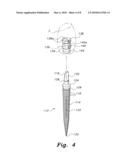 Dental implant system diagram and image